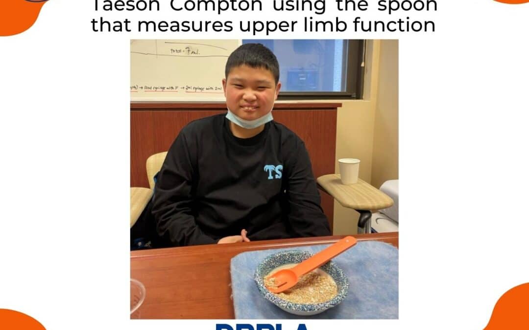 Tracking upper limb function in DRPLA